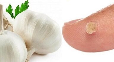 karpų gydymas liaudies gynimo priemonėmis